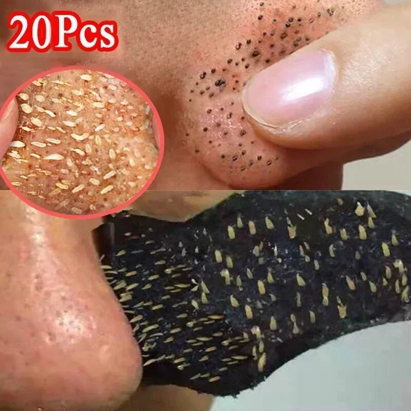 FREE SHIPPING/  10-50PCS Nose Blackhead Remover Mask Shrink Pore Acne Treatment Sticker Black Dots