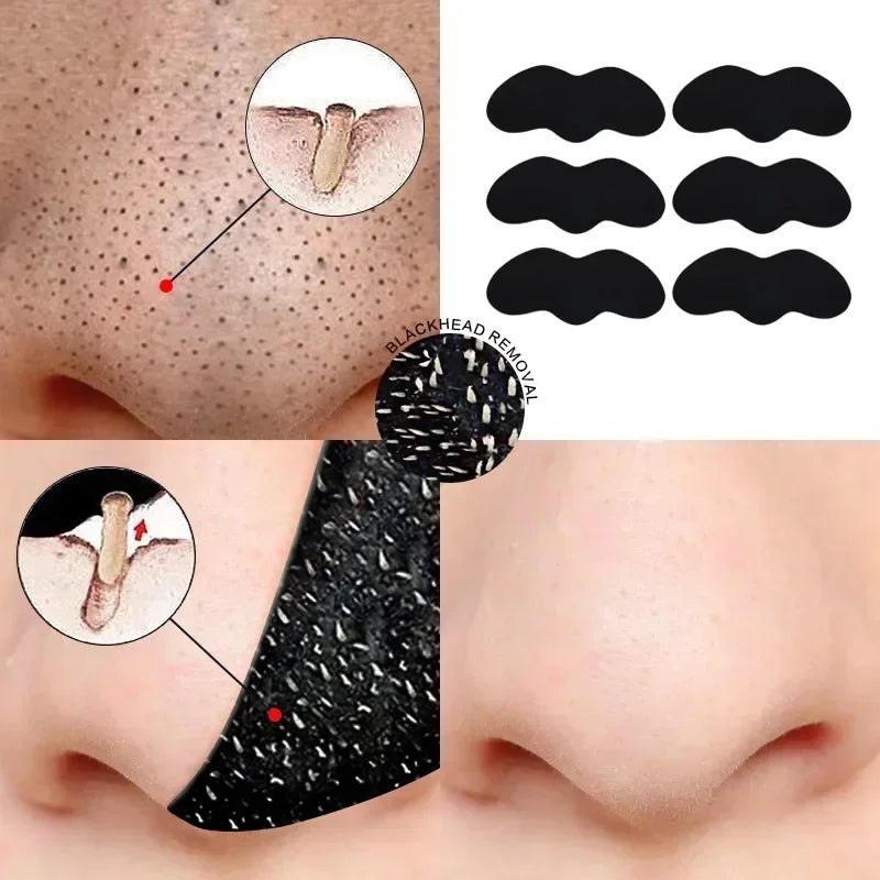 FREE SHIPPING/  10-50PCS Nose Blackhead Remover Mask Shrink Pore Acne Treatment Sticker Black Dots